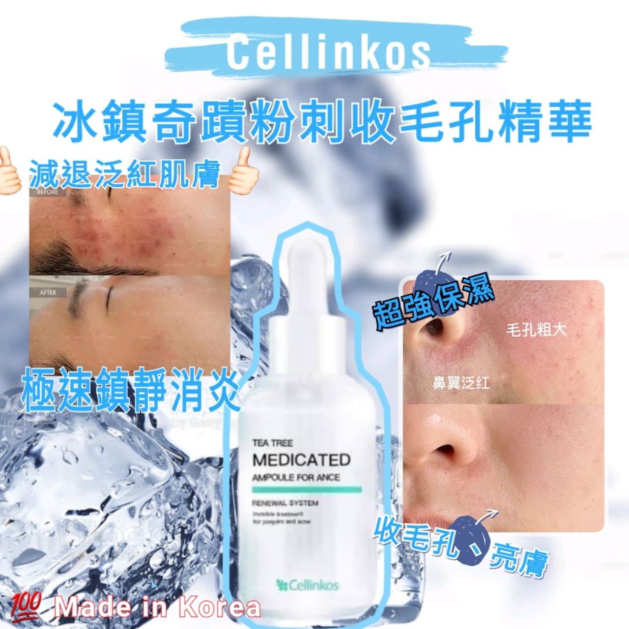 Cellinkos Tea Tree Medicated Ampoule 消炎粉刺收毛孔精華 30ml (韓國製)