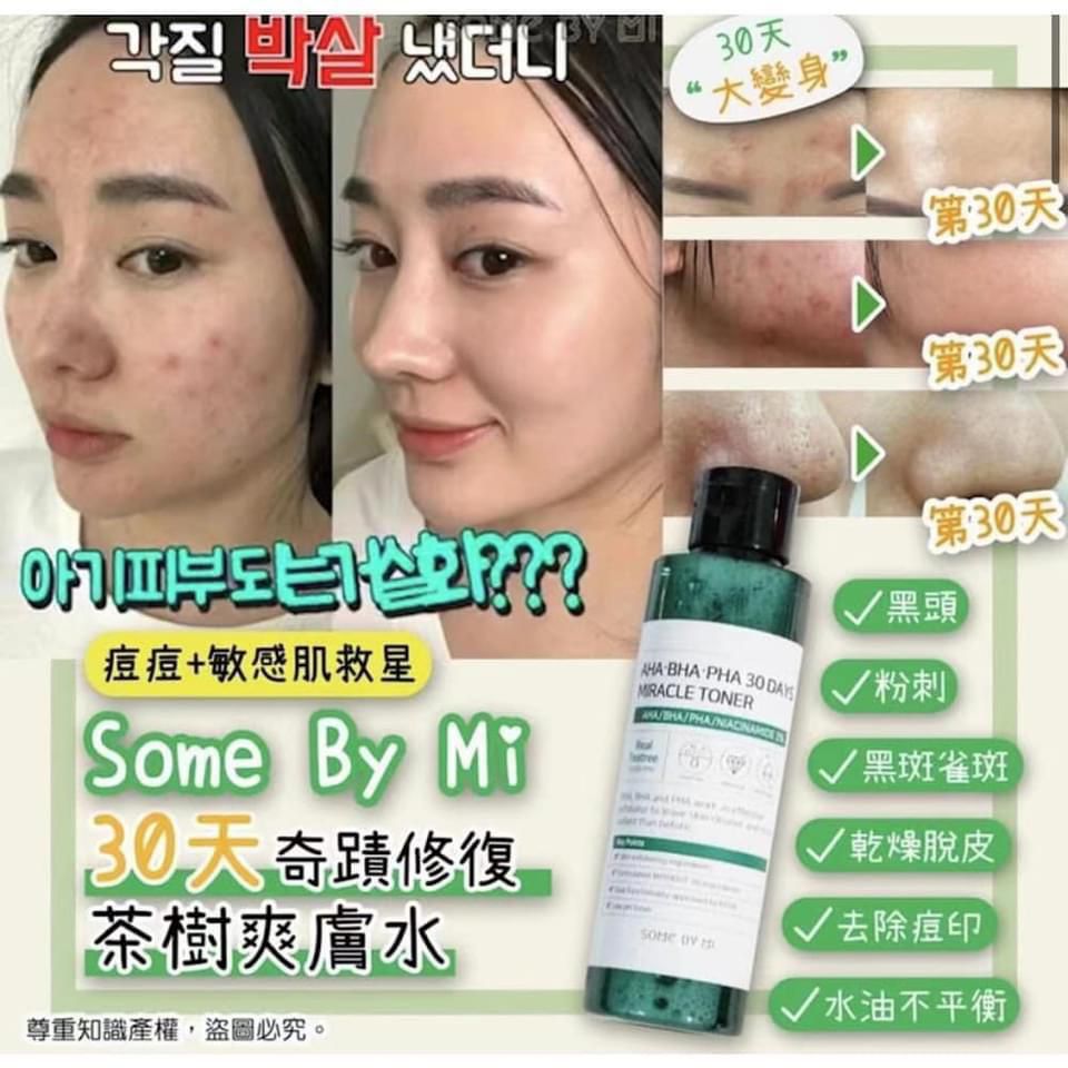 SOME BY MI 30天 奇蹟修復茶樹爽膚水 150ml (MADE IN KOREA)